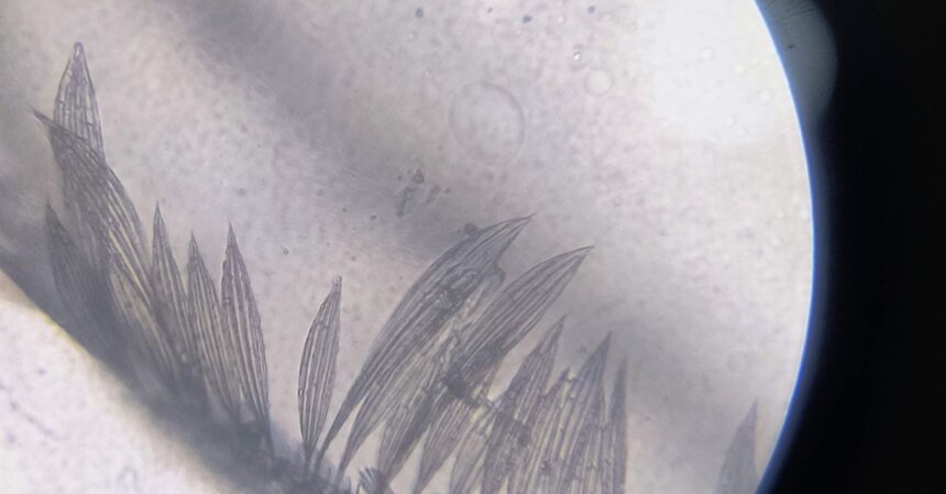 Nikon Small World in Motion winner reveals the mechanics of human respiration | Smart Tech, Sharp Takes - CRYOVEX.com Detailed view of plant structure under microscope, showcasing feathery patterns.